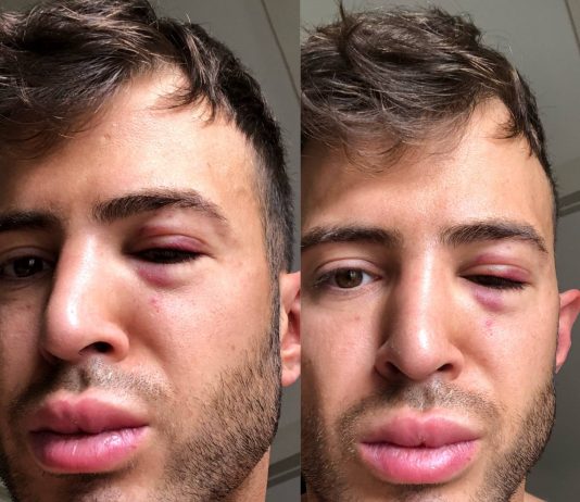 OUTtv presentator pleit voor betere bescherming na nieuw anti-homogeweld